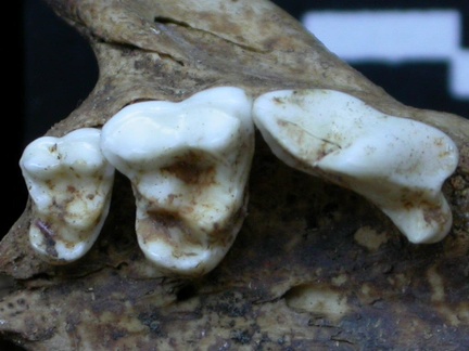 Dentition supérieure