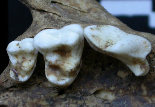 Dentition supérieure