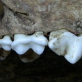 Dentition supérieure