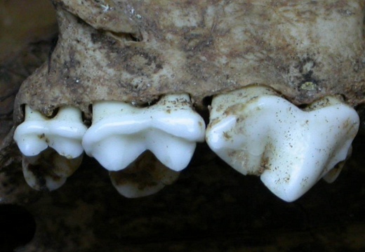 Dentition supérieure