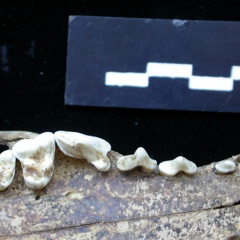 Dentition supérieure