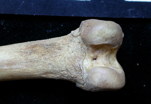 Femur: distal part