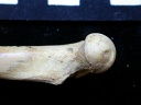 Femur: proximale part