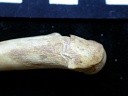 Femur: proximale part