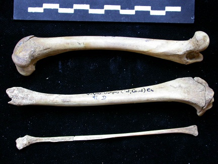  Femur, tibia and fibula