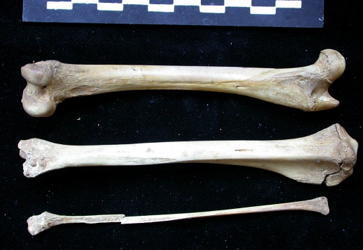  Femur, tibia and fibula