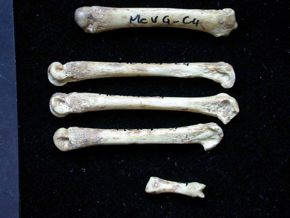 Metacarpals