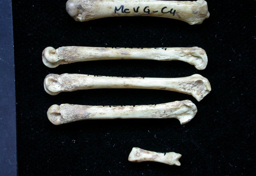 Metacarpals