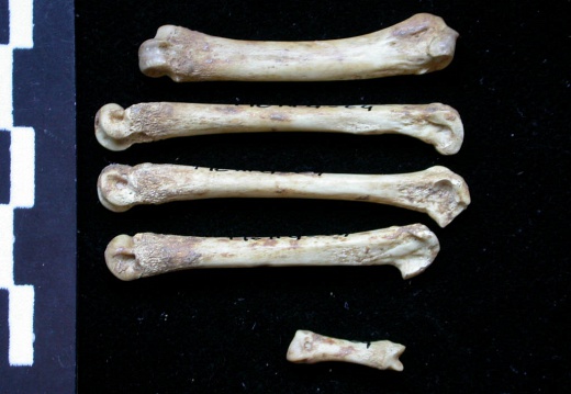 Metacarpals