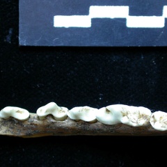 Mandibule