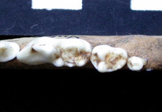 Lower teeth