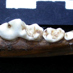 Dentition inférieure