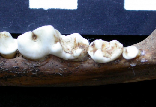 Lower teeth