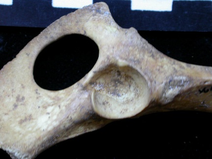 Coxal: acetabulum