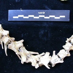 Vertebrae