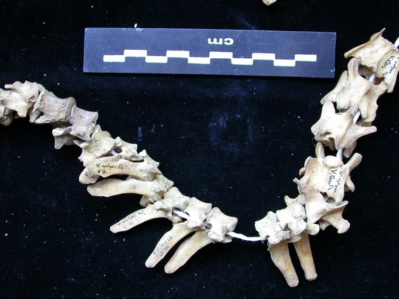 Vertebrae