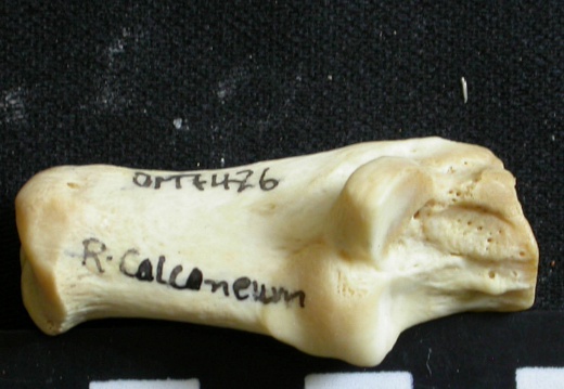 Calcaneus