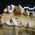 Dentition supérieure