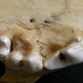 Dentition supérieure