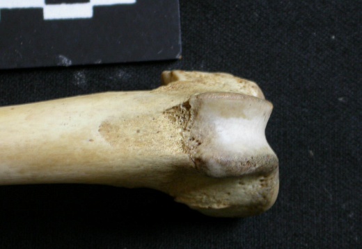 Femur: distal part