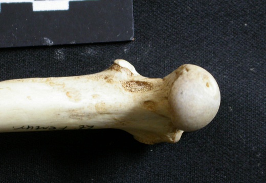 Femur: proximale part