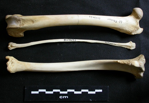  Femur, tibia and fibula