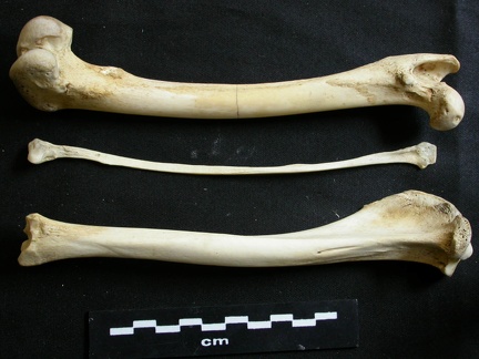  Femur, tibia and fibula