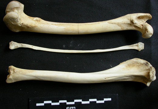 Fémur, tibia et fibula