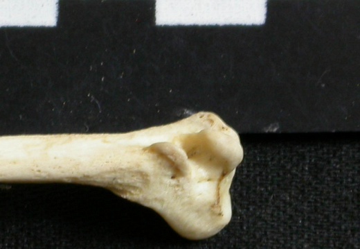 Fibula: distal part