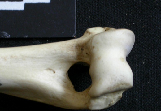 Humerus: distal part