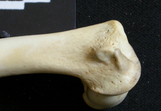 Humerus: distal part