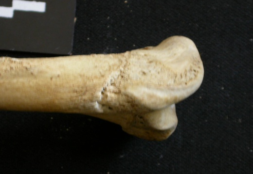 Humerus: proximale part