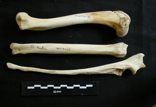 Humerus,radius and ulna