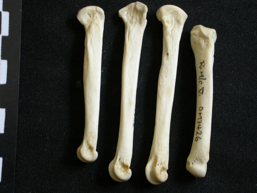 Metacarpals