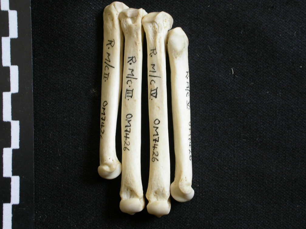 Metacarpals