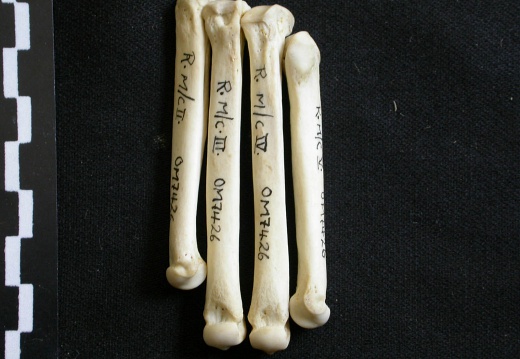 Metacarpals