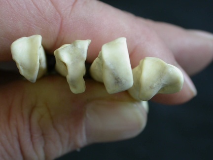 Metacarpianos : parte proximal (7748 visitas) Lycaon pictus - Macho - Adulto - Elementos derechosColección : Departamento d'Osteología del Muse... Metacarpianos : parte proximal