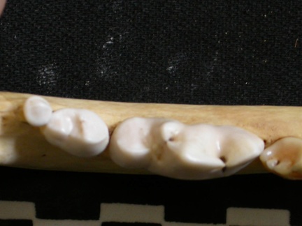 Lower teeth