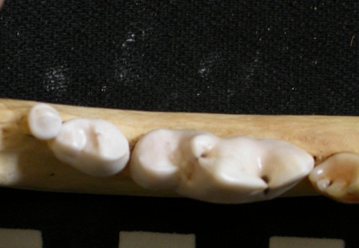 Lower teeth