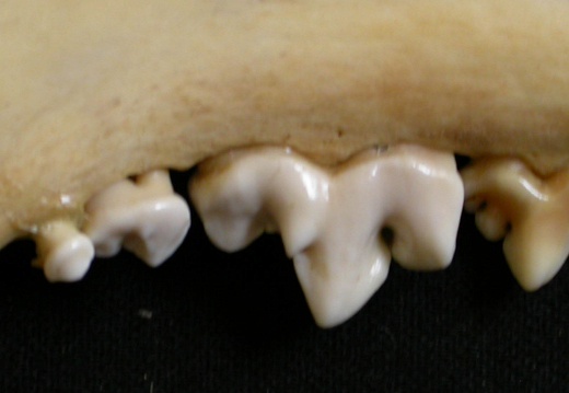 Lower teeth