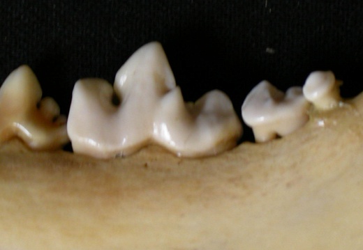 Lower teeth