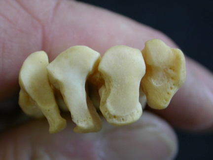 Metatarsianos : parte proximal