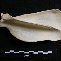 Scapula : vue latérale