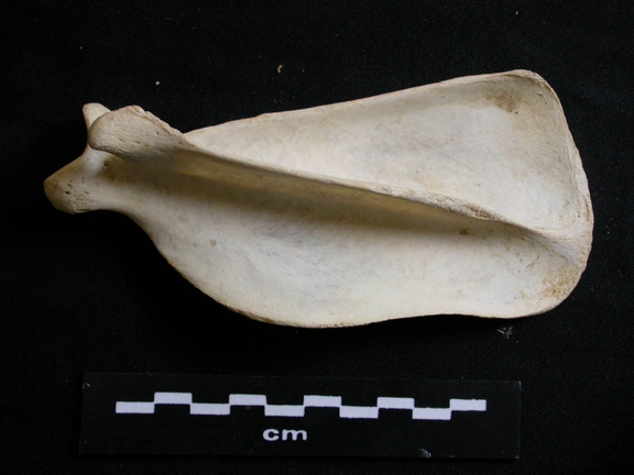 Scapula : vue latérale