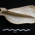 Scapula : vue latérale