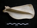 Scapula : vue latérale