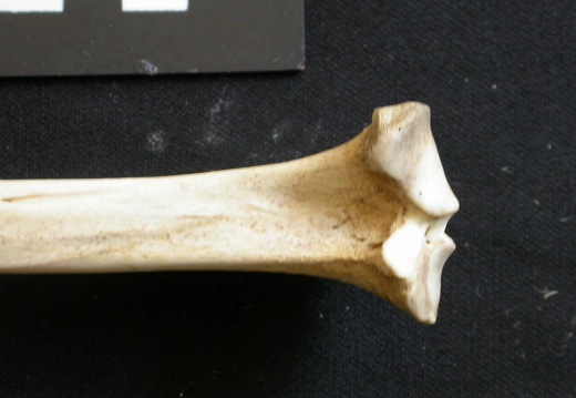  Tibia: proximale part