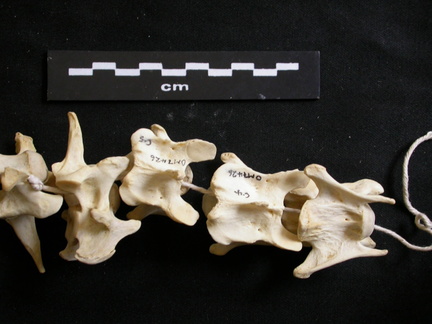 Vertèbres cervicales