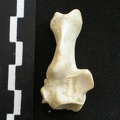 Calcaneus