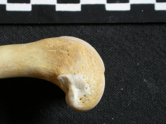 Fémur : partie distale